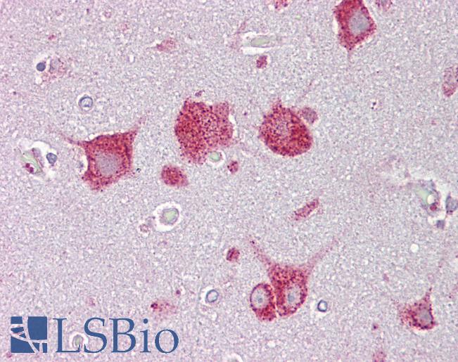 HEXA Antibody - Anti-HEXA antibody IHC of human brain, cortex. Immunohistochemistry of formalin-fixed, paraffin-embedded tissue after heat-induced antigen retrieval. Antibody concentration 5 ug/ml.  This image was taken for the unconjugated form of this product. Other forms have not been tested.