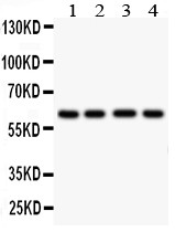 HEXA Antibody - HEXA antibody Western blot. All lanes: Anti HEXA at 0.5 ug/ml. Lane 1: Human Placenta Tissue Lysate at 50 ug. Lane 2: HELA Whole Cell Lysate at 40 ug. Lane 3: HEPG2 Whole Cell Lysate at 40 ug. Lane 4: U87 Whole Cell Lysate at 40 ug. Predicted band size: 61 kD. Observed band size: 61 kD.