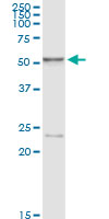 HEXA Antibody - HEXA monoclonal antibody (M06), clone 3D1. Western Blot analysis of HEXA expression in human kidney.