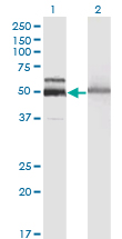 HEXA Antibody - Western Blot analysis of HEXA expression in transfected 293T cell line by HEXA monoclonal antibody (M06), clone 3D1.Lane 1: HEXA transfected lysate(60.7 KDa).Lane 2: Non-transfected lysate.
