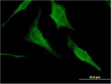 HEXA Antibody - Immunofluorescence of monoclonal antibody to HEXA on HeLa cell . [antibody concentration 10 ug/ml]