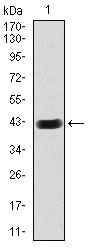 HEXA Antibody - Western blot using HEXA monoclonal antibody against human HEXA (AA: 29-181) recombinant protein. (Expected MW is 43.1 kDa)