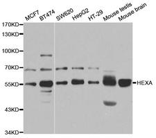 HEXA Antibody - Western blot analysis of extracts of various cell lines.