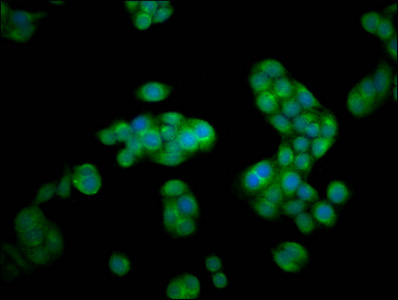 HEXA Antibody - Immunofluorescence staining of PC3 cells at a dilution of 1:100, counter-stained with DAPI. The cells were fixed in 4% formaldehyde, permeabilized using 0.2% Triton X-100 and blocked in 10% normal Goat Serum. The cells were then incubated with the antibody overnight at 4 °C.The secondary antibody was Alexa Fluor 488-congugated AffiniPure Goat Anti-Rabbit IgG (H+L) .