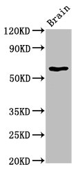 HEXA Antibody - Positive Western Blot detected in Rat brain tissue. All lanes: HEXA antibody at 5.8 µg/ml Secondary Goat polyclonal to rabbit IgG at 1/50000 dilution. Predicted band size: 61, 20 KDa. Observed band size: 61 KDa