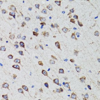 HEXA Antibody - Immunohistochemistry of paraffin-embedded rat brain using HEXA antibody at dilution of 1:100 (40x lens).