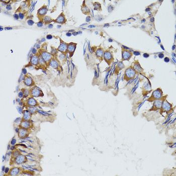 HEXA Antibody - Immunohistochemistry of paraffin-embedded mouse testis using HEXA antibody at dilution of 1:100 (40x lens).