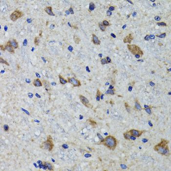HEXA Antibody - Immunohistochemistry of paraffin-embedded mouse spinal cord using HEXA antibody at dilution of 1:100 (40x lens).