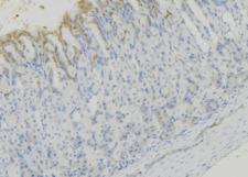 HEXA Antibody - 1:100 staining human gastric tissue by IHC-P. The sample was formaldehyde fixed and a heat mediated antigen retrieval step in citrate buffer was performed. The sample was then blocked and incubated with the antibody for 1.5 hours at 22°C. An HRP conjugated goat anti-rabbit antibody was used as the secondary.