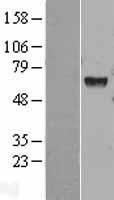 HEXA Protein - Western validation with an anti-DDK antibody * L: Control HEK293 lysate R: Over-expression lysate