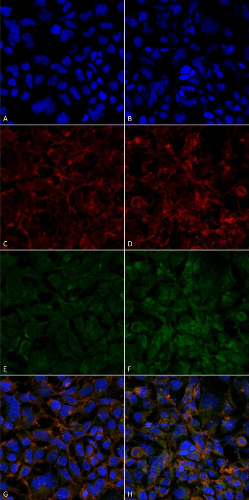 Hexanoyl-Lysine adduct Antibody - Immunocytochemistry/Immunofluorescence analysis using Mouse Anti-Hexanoyl-Lysine adduct Monoclonal Antibody, Clone 5E8. Tissue: Embryonic kidney epithelial cell line (HEK293). Species: Human. Fixation: 5% Formaldehyde for 5 min. Primary Antibody: Mouse Anti-Hexanoyl-Lysine adduct Monoclonal Antibody at 1:50 for 30-60 min at RT. Secondary Antibody: Goat Anti-Mouse Alexa Fluor 488 at 1:1500 for 30-60 min at RT. Counterstain: Phalloidin Alexa Fluor 633 F-Actin stain; DAPI (blue) nuclear stain at 1:250, 1:50000 for 30-60 min at RT. Magnification: 20X (2X Zoom). (A,C,E,G) - Untreated. (B,D,F,H) - Cells cultured overnight with 50 µM H2O2. (A,B) DAPI (blue) nuclear stain. (C,D) Phalloidin Alexa Fluor 633 F-Actin stain. (E,F) Hexanoyl-Lysine adduct Antibody. (G,H) Composite. Courtesy of: Dr. Robert Burke, University of Victoria.