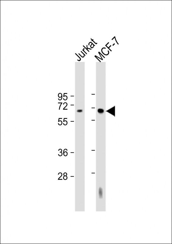 HEXB Antibody - All lanes: Anti-HEXB Antibody (Center) at 1:2000 dilution. Lane 1: Jurkat whole cell lysate. Lane 2: MCF-7 whole cell lysate Lysates/proteins at 20 ug per lane. Secondary Goat Anti-Rabbit IgG, (H+L), Peroxidase conjugated at 1:10000 dilution. Predicted band size: 63 kDa. Blocking/Dilution buffer: 5% NFDM/TBST.