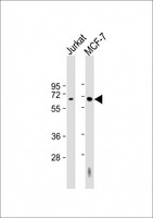 HEXB Antibody - All lanes: Anti-HEXB Antibody (Center) at 1:2000 dilution. Lane 1: Jurkat whole cell lysate. Lane 2: MCF-7 whole cell lysate Lysates/proteins at 20 ug per lane. Secondary Goat Anti-Rabbit IgG, (H+L), Peroxidase conjugated at 1:10000 dilution. Predicted band size: 63 kDa. Blocking/Dilution buffer: 5% NFDM/TBST.