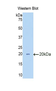 HEXB Antibody - Western blot of recombinant HEXB.  This image was taken for the unconjugated form of this product. Other forms have not been tested.