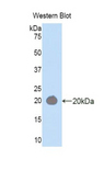 HEXB Antibody - Western blot of recombinant HEXB.  This image was taken for the unconjugated form of this product. Other forms have not been tested.
