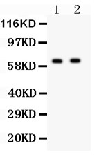 HEXB Antibody - HEXB antibody Western blot. All lanes: Anti HEXB at 0.5 ug/ml. Lane 1: HELA Whole Cell Lysate at 40 ug. Lane 2: HEPG2 Whole Cell Lysate at 40 ug. Predicted band size: 63 kD. Observed band size: 63 kD.
