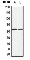 HEXB Antibody - Western blot analysis of HEXB expression in HepG2 (A); HeLa (B) whole cell lysates.
