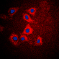 HEXB Antibody - Immunofluorescent analysis of HEXB staining in HepG2 cells. Formalin-fixed cells were permeabilized with 0.1% Triton X-100 in TBS for 5-10 minutes and blocked with 3% BSA-PBS for 30 minutes at room temperature. Cells were probed with the primary antibody in 3% BSA-PBS and incubated overnight at 4 C in a humidified chamber. Cells were washed with PBST and incubated with a DyLight 594-conjugated secondary antibody (red) in PBS at room temperature in the dark. DAPI was used to stain the cell nuclei (blue).