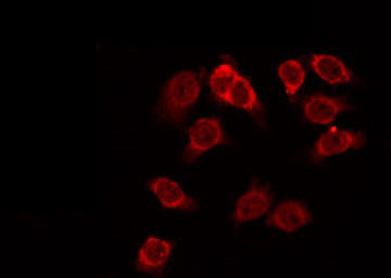 HEXB Antibody - Staining HeLa cells by IF/ICC. The samples were fixed with PFA and permeabilized in 0.1% Triton X-100, then blocked in 10% serum for 45 min at 25°C. The primary antibody was diluted at 1:200 and incubated with the sample for 1 hour at 37°C. An Alexa Fluor 594 conjugated goat anti-rabbit IgG (H+L) Ab, diluted at 1/600, was used as the secondary antibody.