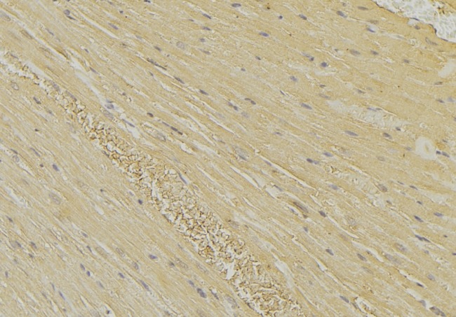 HEXB Antibody - 1:100 staining mouse muscle tissue by IHC-P. The sample was formaldehyde fixed and a heat mediated antigen retrieval step in citrate buffer was performed. The sample was then blocked and incubated with the antibody for 1.5 hours at 22°C. An HRP conjugated goat anti-rabbit antibody was used as the secondary.