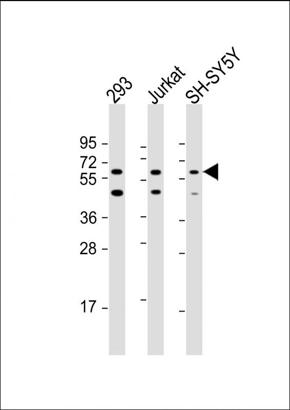 HEXDC Antibody - All lanes: Anti-HEXDC Antibody (N-Term) at 1:2000 dilution Lane 1: 293 whole cell lysate Lane 2: Jurkat whole cell lysate Lane 3: SH-SY5Y whole cell lysate Lysates/proteins at 20 µg per lane. Secondary Goat Anti-Rabbit IgG, (H+L), Peroxidase conjugated at 1/10000 dilution. Predicted band size: 54 kDa Blocking/Dilution buffer: 5% NFDM/TBST.