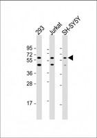 HEXDC Antibody - All lanes: Anti-HEXDC Antibody (N-Term) at 1:2000 dilution Lane 1: 293 whole cell lysate Lane 2: Jurkat whole cell lysate Lane 3: SH-SY5Y whole cell lysate Lysates/proteins at 20 µg per lane. Secondary Goat Anti-Rabbit IgG, (H+L), Peroxidase conjugated at 1/10000 dilution. Predicted band size: 54 kDa Blocking/Dilution buffer: 5% NFDM/TBST.