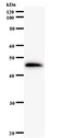 HEXIM1 Antibody - Western blot of immunized recombinant protein using HEXIM1 antibody.