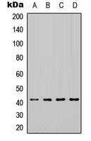 HEXIM1 Antibody - Western blot analysis of HEXIM1 expression in A431 (A); Jurkat (B); NIH3T3 (C); rat heart (D) whole cell lysates.