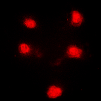 HEXIM1 Antibody - Immunofluorescent analysis of HEXIM1 staining in A431 cells. Formalin-fixed cells were permeabilized with 0.1% Triton X-100 in TBS for 5-10 minutes and blocked with 3% BSA-PBS for 30 minutes at room temperature. Cells were probed with the primary antibody in 3% BSA-PBS and incubated overnight at 4 ??C in a humidified chamber. Cells were washed with PBST and incubated with a DyLight 594-conjugated secondary antibody (red) in PBS at room temperature in the dark. DAPI was used to stain the cell nuclei (blue).
