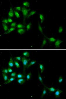 HEXIM1 Antibody - Immunofluorescence analysis of A549 cells.