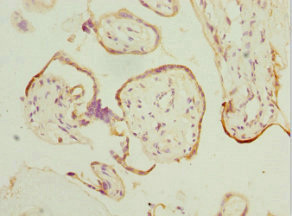 HEXIM1 Antibody - Immunohistochemistry of paraffin-embedded human placenta tissues at dilution 1:100