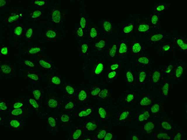 HEXIM1 Antibody - Immunofluorescence staining of HEXIM1 in U2OS cells. Cells were fixed with 4% PFA, permeabilzed with 0.1% Triton X-100 in PBS, blocked with 10% serum, and incubated with rabbit anti-Human HEXIM1 polyclonal antibody (dilution ratio 1:200) at 4°C overnight. Then cells were stained with the Alexa Fluor 488-conjugated Goat Anti-rabbit IgG secondary antibody (green). Positive staining was localized to Nucleus.