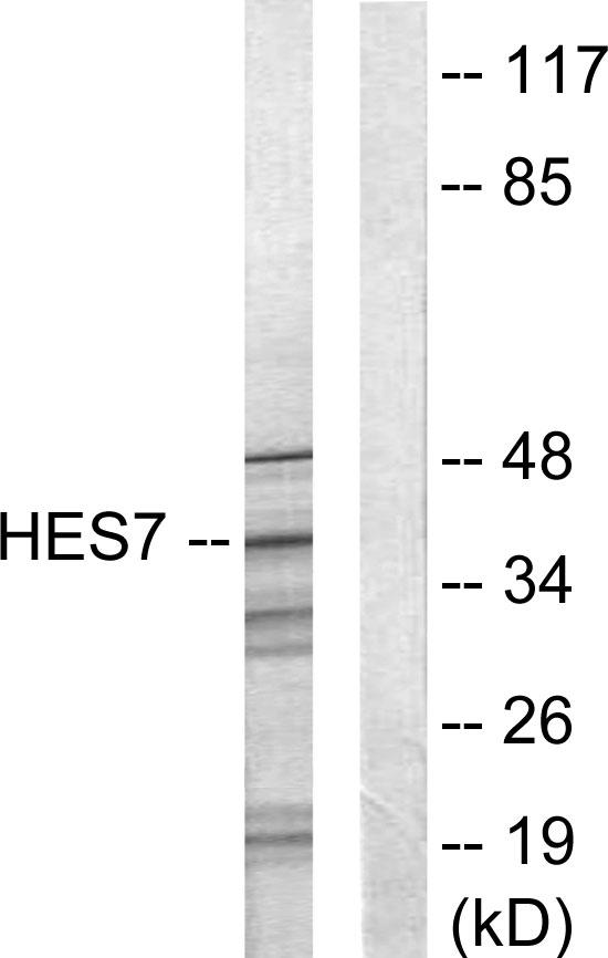 HEXIM1 Antibody - Western blot analysis of extracts from NIH-3T3 cells, using HES7 antibody.