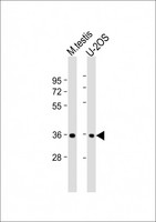 HEXIM2 Antibody - All lanes: Anti-HEXIM2 Antibody (C-Term) at 1:8000 dilution Lane 1: mouse testis lysate Lane 2: U-2OS whole cell lysate Lysates/proteins at 20 µg per lane. Secondary Goat Anti-Rabbit IgG, (H+L), Peroxidase conjugated at 1/10000 dilution. Predicted band size: 32 kDa Blocking/Dilution buffer: 5% NFDM/TBST.