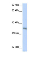 HEXIM2 Antibody - HEXIM2 antibody Western blot of 721_B cell lysate. This image was taken for the unconjugated form of this product. Other forms have not been tested.