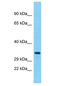 HEY1 Antibody - HEY1 antibody Western Blot of Fetal Kidney. Antibody dilution: 1 ug/ml.  This image was taken for the unconjugated form of this product. Other forms have not been tested.