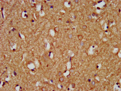 HEY1 Antibody - Immunohistochemistry image at a dilution of 1:200 and staining in paraffin-embedded human brain tissue performed on a Leica BondTM system. After dewaxing and hydration, antigen retrieval was mediated by high pressure in a citrate buffer (pH 6.0) . Section was blocked with 10% normal goat serum 30min at RT. Then primary antibody (1% BSA) was incubated at 4 °C overnight. The primary is detected by a biotinylated secondary antibody and visualized using an HRP conjugated SP system.