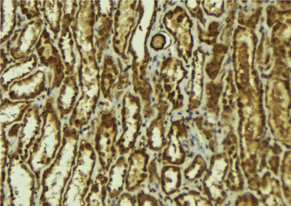 HEY1 Antibody - 1:100 staining mouse kidney tissue by IHC-P. The sample was formaldehyde fixed and a heat mediated antigen retrieval step in citrate buffer was performed. The sample was then blocked and incubated with the antibody for 1.5 hours at 22°C. An HRP conjugated goat anti-rabbit antibody was used as the secondary.