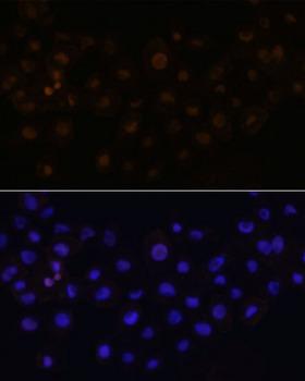 HEY1 Antibody - Immunofluorescence analysis of A431 cells using HEY1 Polyclonal Antibody at dilution of 1:100.Blue: DAPI for nuclear staining.