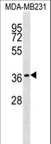 HEYL Antibody - HEYL Antibody western blot of MDA-MB231 cell line lysates (35 ug/lane). The HEYL antibody detected the HEYL protein (arrow).