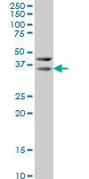 HEYL Antibody - HEYL monoclonal antibody (M07), clone 1F6 Western blot of HEYL expression in HeLa.