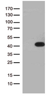 HEYL Antibody - HEK293T cells were transfected with the pCMV6-ENTRY control. (Left lane) or pCMV6-ENTRY HEYL. (Right lane) cDNA for 48 hrs and lysed. Equivalent amounts of cell lysates. (5 ug per lane) were separated by SDS-PAGE and immunoblotted with anti-HEYL. (1:2000)