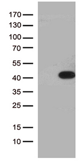 HEYL Antibody - HEK293T cells were transfected with the pCMV6-ENTRY control. (Left lane) or pCMV6-ENTRY HEYL. (Right lane) cDNA for 48 hrs and lysed