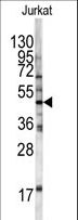 HFE Antibody - Western blot of HFE antibody in Jurkat cell line lysates (35 ug/lane). HFE (arrow) was detected using the purified antibody.