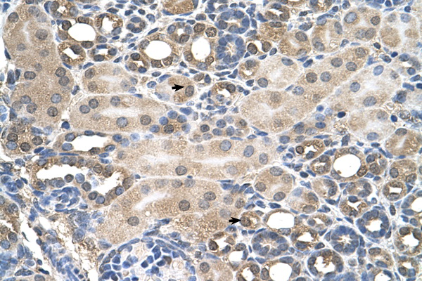 HFE Antibody - HFE antibody ARP44285_P050-NP_620577-HFE(hemochromatosis) Antibody IHC of formalin-fixed, paraffin-embedded human Kidney. Positive label: Epithelial cells of renal tubule indicated with arrows. Antibody concentration 4-8 ug/ml. Magnification 400X.  This image was taken for the unconjugated form of this product. Other forms have not been tested.