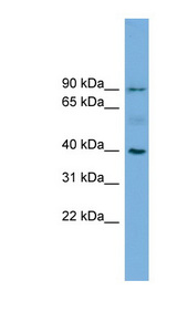 HFE Antibody - HFE antibody Western blot of HeLa lysate. This image was taken for the unconjugated form of this product. Other forms have not been tested.