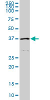 HFE Antibody - HFE monoclonal antibody (M01), clone 1G12. Western Blot analysis of HFE expression in A-431.