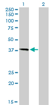 HFE Antibody - Western Blot analysis of HFE expression in transfected 293T cell line by HFE monoclonal antibody (M01), clone 1G12.Lane 1: HFE transfected lysate(40.1 KDa).Lane 2: Non-transfected lysate.