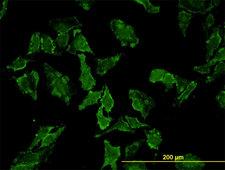 HFE Antibody - Immunofluorescence of monoclonal antibody to HFE on HeLa cell. [antibody concentration 10 ug/ml]