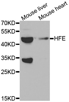 HFE Antibody - Western blot analysis of extracts of various cell lines, using HFE antibody at 1:1000 dilution. The secondary antibody used was an HRP Goat Anti-Rabbit IgG (H+L) at 1:10000 dilution. Lysates were loaded 25ug per lane and 3% nonfat dry milk in TBST was used for blocking.